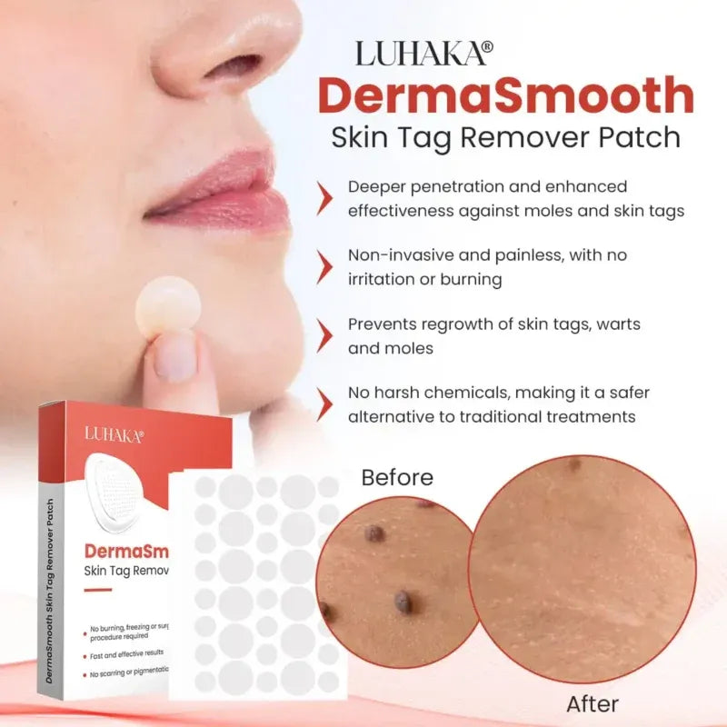 Derma Smooth Skin Tag Removal Patches ❤️🩹 | Secret to Spotless Skin ✨